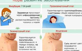 Почему от соплей начинается кашель у ребенка. Что делать, если начинается кашель у ребенка. Как лечить кашель после насморка у ребенка