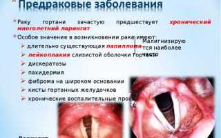 Симптомы и методы лечения при плоскоклеточном раке гортани