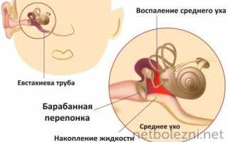 Что лучше «изофра» или «полидекса» при гайморите и затяжном насморке, отличия