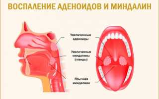 Ночной кашель у ребенка причины и лечение комаровский