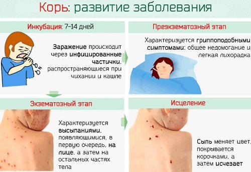 Корь