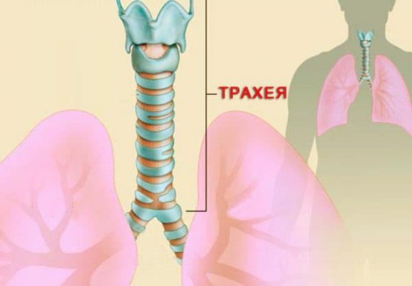 Трахеит - это поражение трахеи вирусами, бактериями или аллергенами