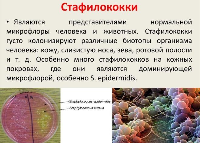 Золотистый стафилококк является возбудителем болезни